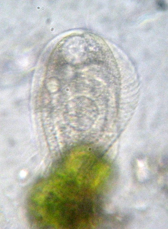 Protozoi del muschio: Phacodinium metchnicoffi ?